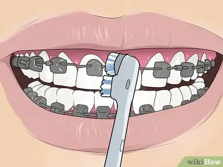 Image intitulée Use an Electric Toothbrush with Braces Step 13