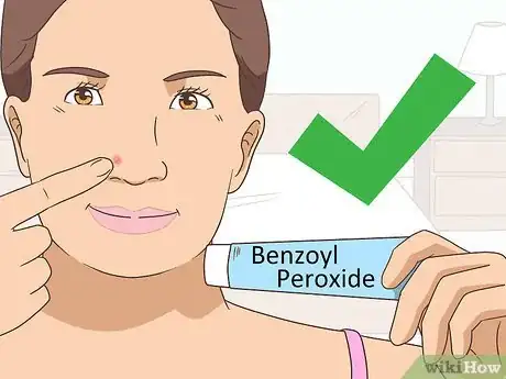 Image intitulée Get Rid of a Pimple Step 5