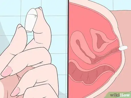 Image intitulée Insert Progesterone Suppositories Without an Applicator Step 5