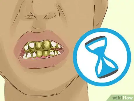 Image intitulée Clean Gold Teeth Step 11