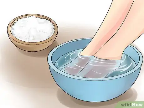 Image intitulée Prevent Smelly Feet Step 15