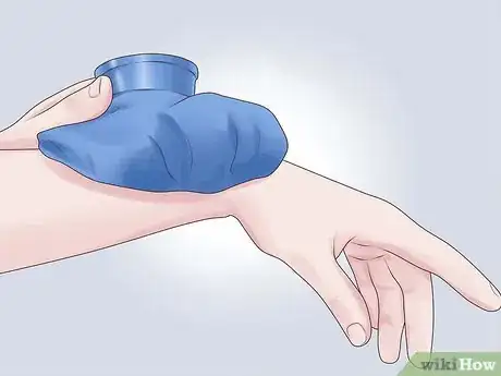 Image intitulée Prevent Carpal Tunnel Syndrome Step 14