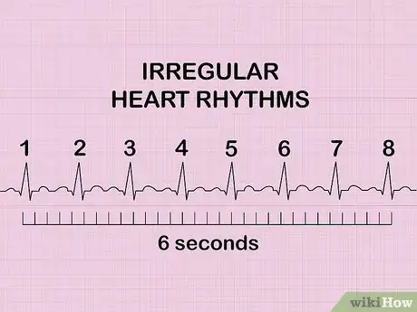 Image intitulée Calculate Heart Rate from ECG Step 8