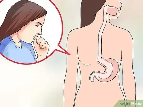 Image intitulée Cure Esophagitis Step 1