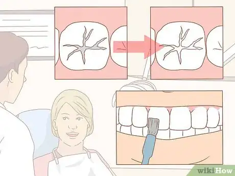 Image intitulée Take Good Care of Your Teeth Step 14