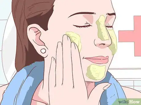 Image intitulée Get Rid of Acne Without Using Medication Step 20