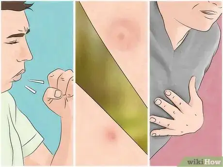 Image intitulée Get Rid of Bug Bites Step 25