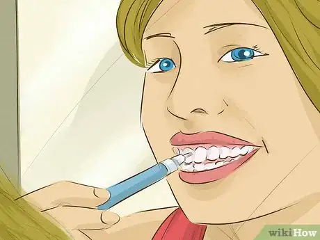 Image intitulée Whiten Teeth Step 21