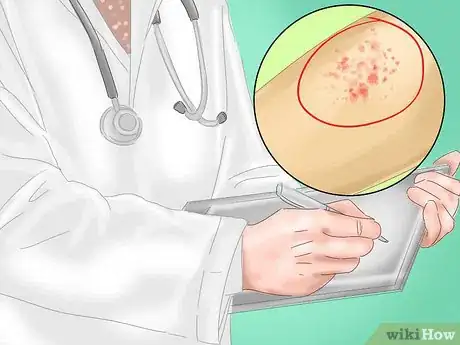 Image intitulée Identify Measles Step 5