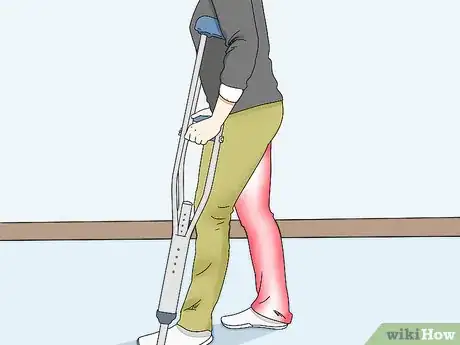 Image intitulée Make Your Crutches More Comfortable Step 7