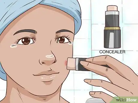 Image intitulée Painlessly Pop a Pimple Step 11