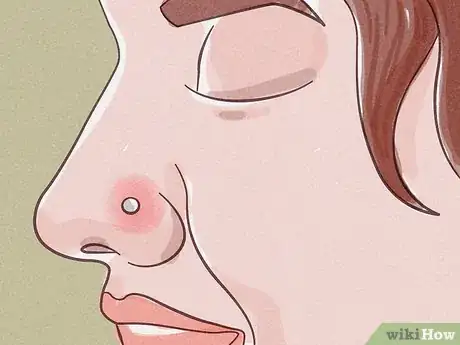 Image intitulée Treat an Infected Nose Piercing Step 1