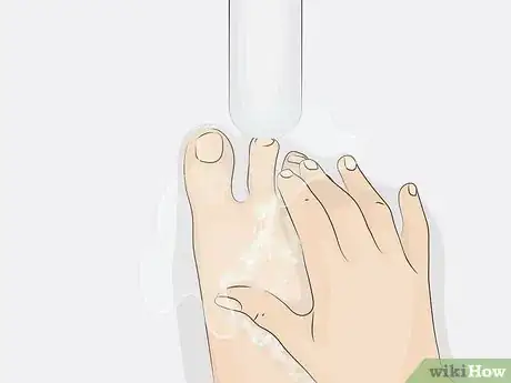 Image intitulée Cure Onycholysis Step 11