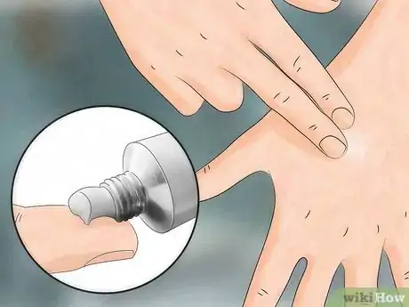 Image intitulée Reduce the Pain of Gnat Bites Step 5