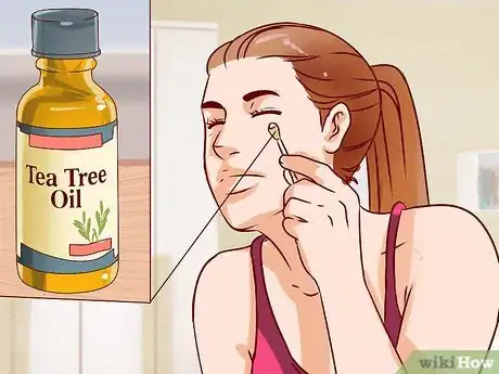 Image intitulée Get Rid of a Hard Pimple Step 1