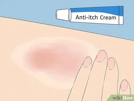 Image intitulée Cope with Itchy Skin During Menopause Step 9