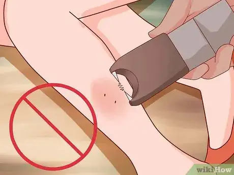 Image intitulée Survive Being Bitten by a Venomous Snake Step 11