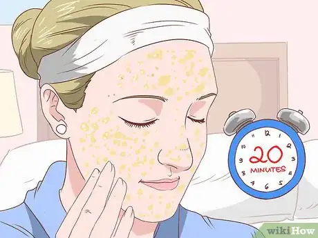 Image intitulée Get Rid of Acne Without Using Medication Step 23