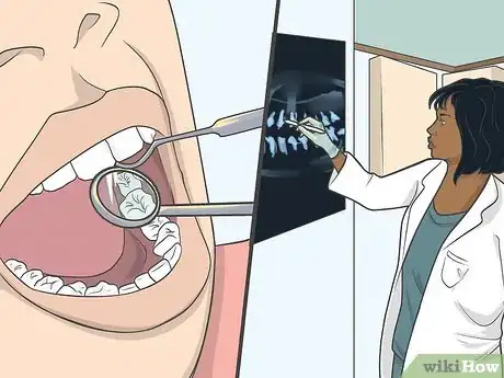 Image intitulée Use Clove Oil for Tooth Pain Step 15