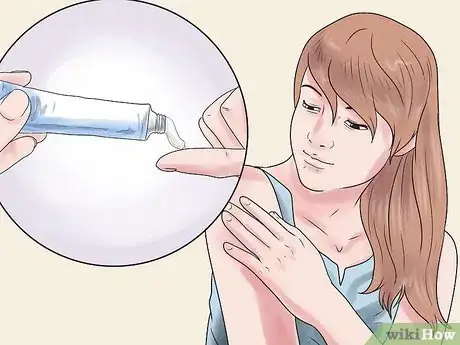 Image intitulée Get Rid of a Skin Rash Caused by Antibiotic Allergy Step 11