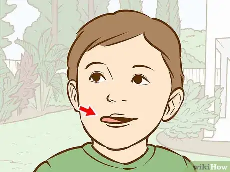 Image intitulée Fix a Toddler's Chapped Lips Step 4