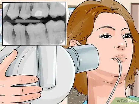 Image intitulée Whiten Teeth Naturally Step 30