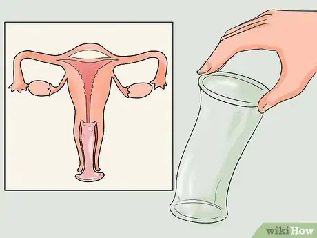 Image intitulée Recognize Trichomoniasis Symptoms (Women) Step 8