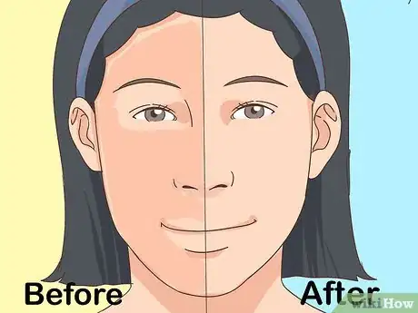 Image intitulée Prevent Vitiligo Step 16