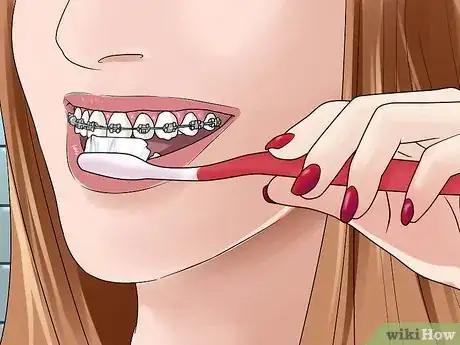 Image intitulée Brush Your Teeth With Braces On Step 2