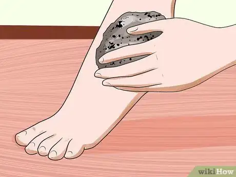 Image intitulée Remove Calluses Naturally Step 10