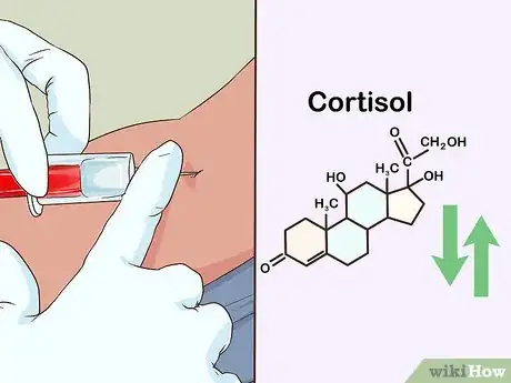 Image intitulée Test Cortisol Levels Step 9