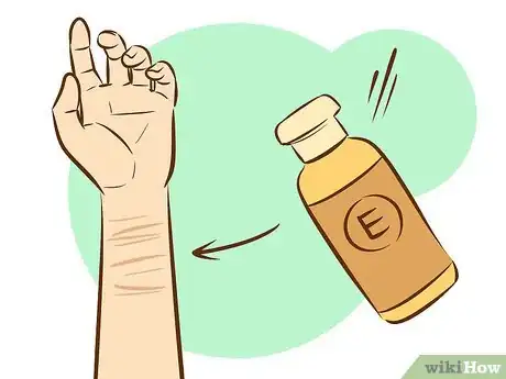 Image intitulée Get Rid of Self Harm Scars Step 10