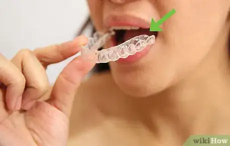 Image intitulée Whiten Your Teeth Without Spending a Lot of Money Step 1