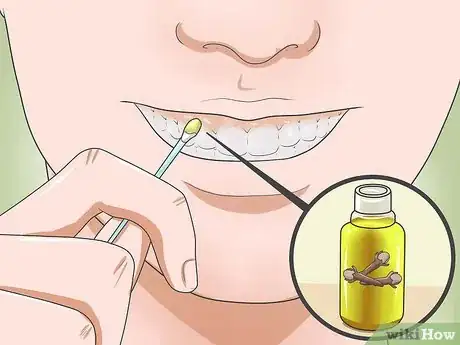 Image intitulée Reduce Gum Swelling Step 9