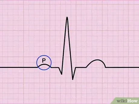 Image intitulée Read an EKG Step 3