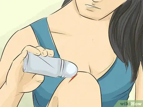 Image intitulée Stop Bleeding Step 9