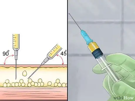 Image intitulée Vaccinate Chickens Step 18