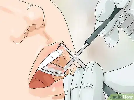 Image intitulée Prevent Cavities Step 5