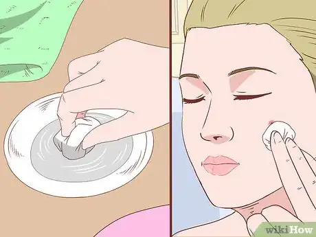 Image intitulée Stop a Zit from Bleeding Step 1