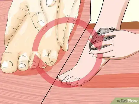 Image intitulée Remove Calluses Naturally Step 11