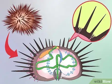 Image intitulée Treat a Sea Urchin Sting Step 2