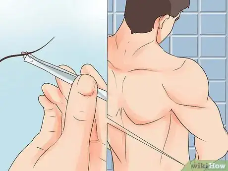 Image intitulée Get Rid of Pubic Lice Step 6