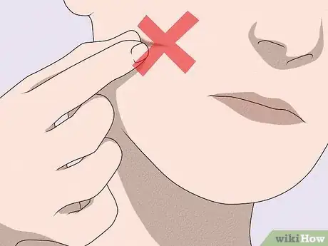 Image intitulée Heal Scratch Marks on Your Face Step 11