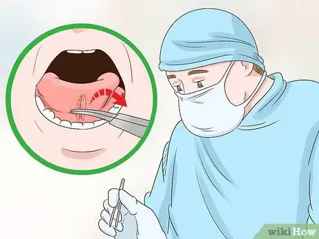 Image intitulée Get a Longer Tongue Step 5