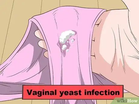 Image intitulée Tell if Vaginal Discharge Is Normal Step 14