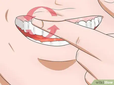 Image intitulée Reduce Gum Swelling Step 8