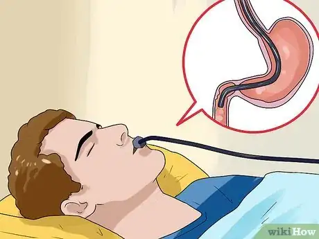 Image intitulée Treat Gastric Ulcer Step 10