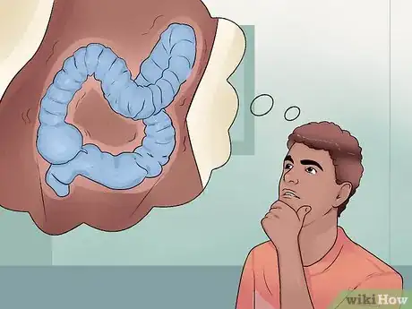 Image intitulée Distinguish Ulcerative Colitis from Similar Conditions Step 8