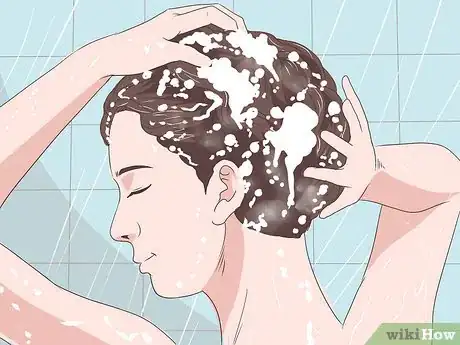 Image intitulée Heal Scalp Eczema Step 9