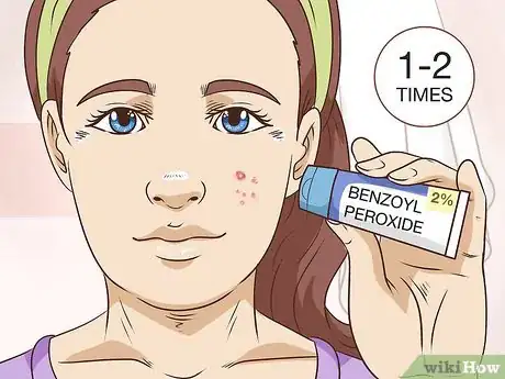 Image intitulée Painlessly Pop a Pimple Step 15